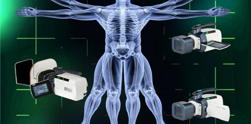 El Tipi X-Ray Çözümleri