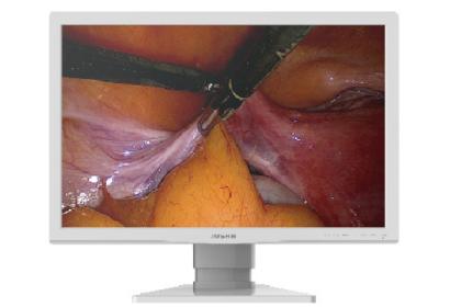 ATC Endüstriyel Monitörler