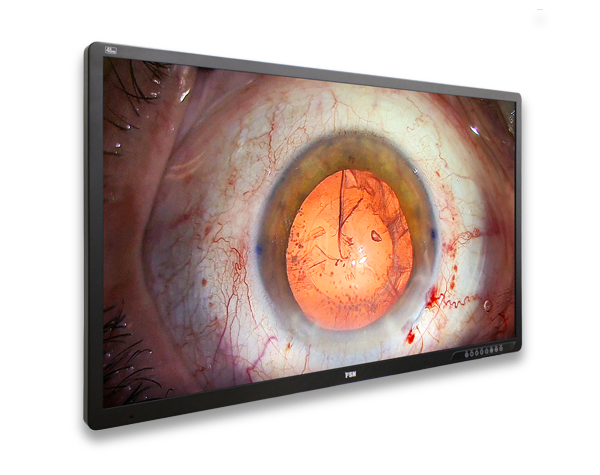 FM-­A5505DGC Rev. 02 55″ 4K 3D Medical Grade Monitor