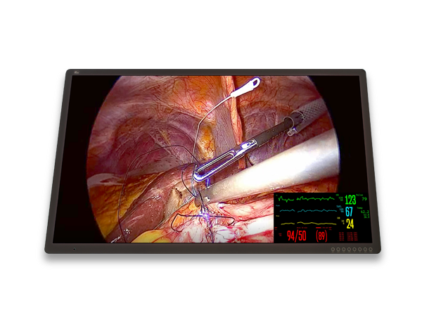 FM-C5501DV 55″ 4K UHD Medical Grade Monitor