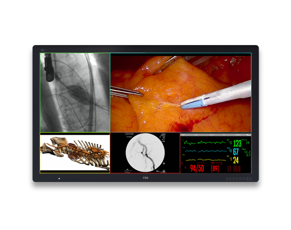 FM-D5802DV 4K UHD DICOM Medical Grade Monitor