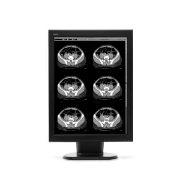 WIDE 21.3″ 2MP Diagnostic Mono Display (MX20N)